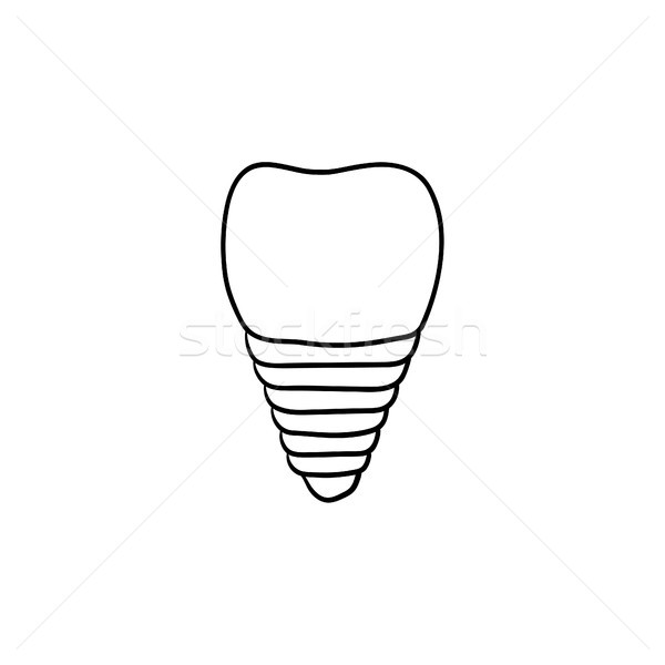 Dental implant hand drawn outline doodle icon. Stock photo © RAStudio