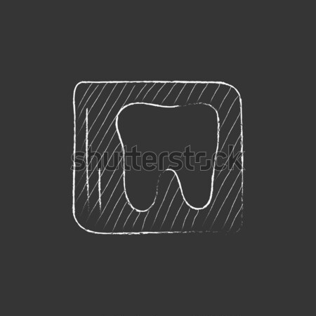 X-ray of tooth. Drawn in chalk icon. Stock photo © RAStudio