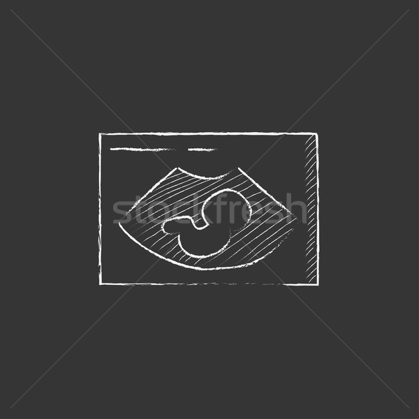 Fetal ultrasound. Drawn in chalk icon. Stock photo © RAStudio