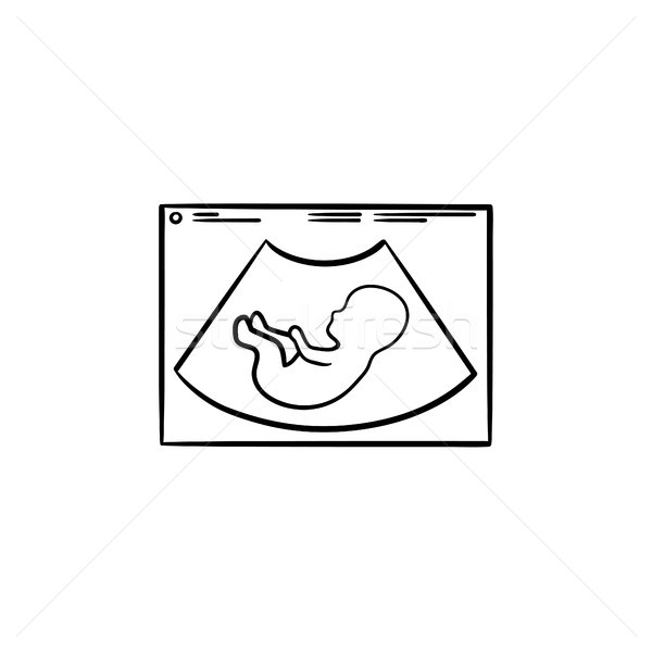 超聲 手工繪製 塗鴉 圖標 懷孕 商業照片 © RAStudio