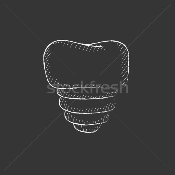 Tooth implant. Drawn in chalk icon. Stock photo © RAStudio