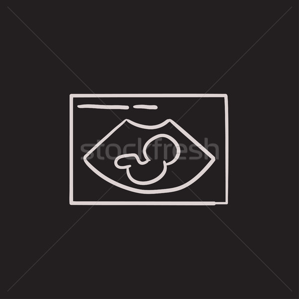 Fetal ultrasound sketch icon. Stock photo © RAStudio
