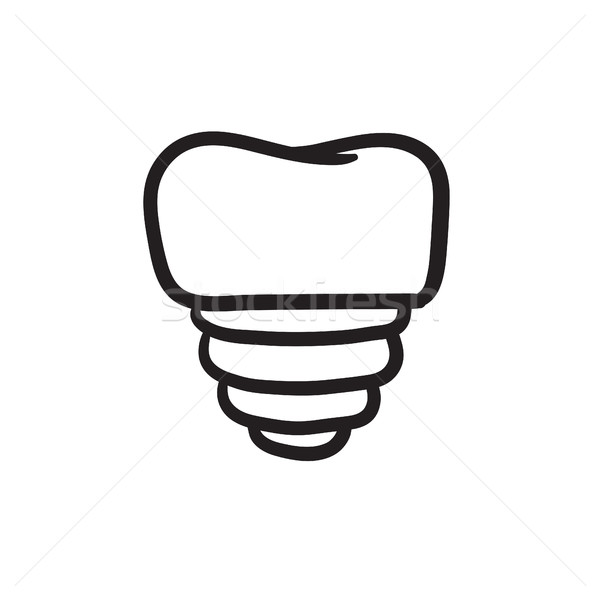 зубов имплантат эскиз икона вектора изолированный Сток-фото © RAStudio