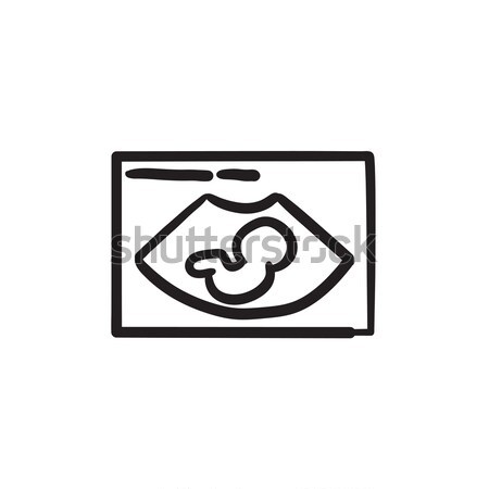Stock photo: Fetal ultrasound sketch icon.