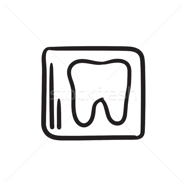 X-ray of tooth sketch icon. Stock photo © RAStudio