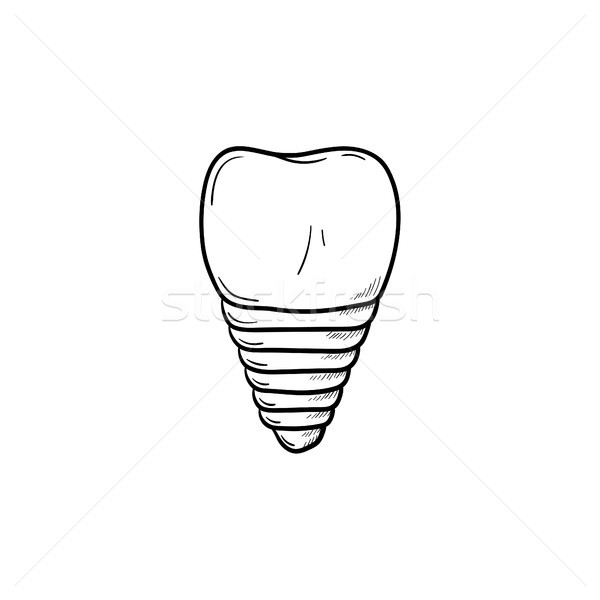 Dental implant hand drawn outline doodle icon. Stock photo © RAStudio