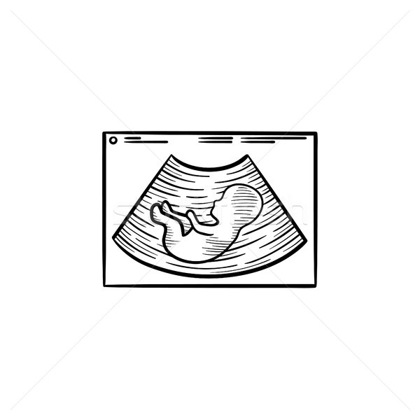 Ultrahang kézzel rajzolt skicc firka ikon terhesség Stock fotó © RAStudio