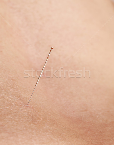 Acupunctuur naald macro afbeelding huid geneeskunde Stockfoto © RazvanPhotography