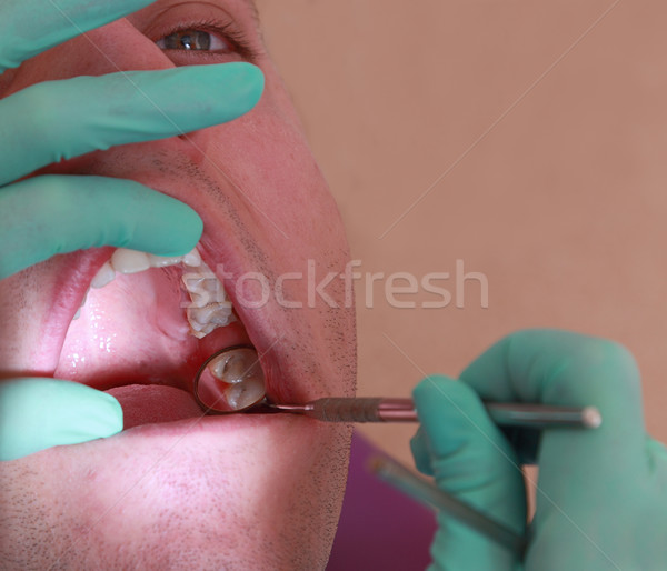 Dental abstract Stock photo © RazvanPhotography