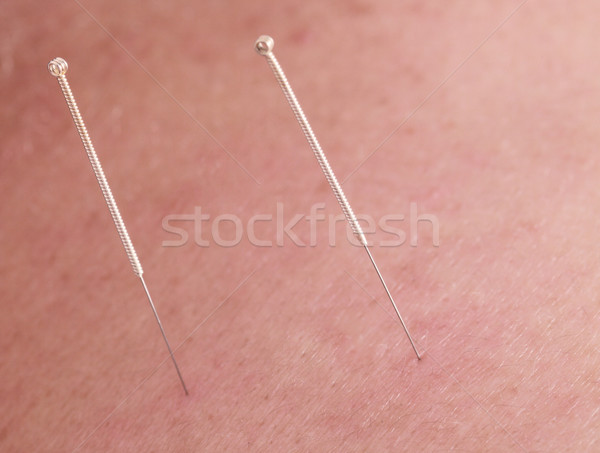 Acupuntura agujas macro imagen dos piel Foto stock © RazvanPhotography