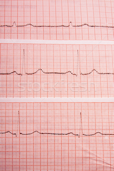 Heart rate on medical print out Stock photo © restyler