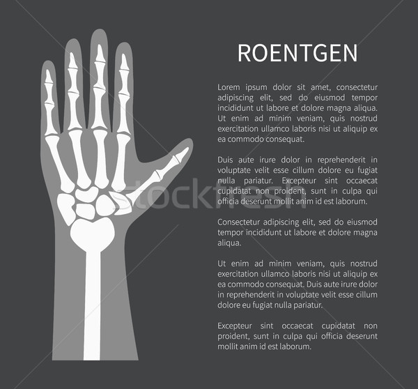 Roentgen Poster and Text, Vector Illustration Stock photo © robuart