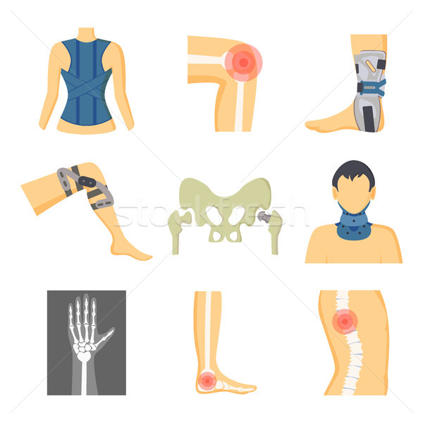 Orthopedics Fixing Tools and Pain in Bones Image Stock photo © robuart