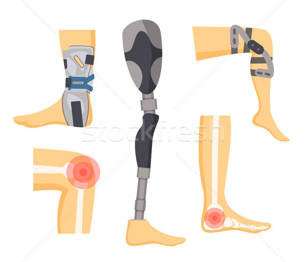 Douleur joints orthopédique jambes coloré blanche Photo stock © robuart