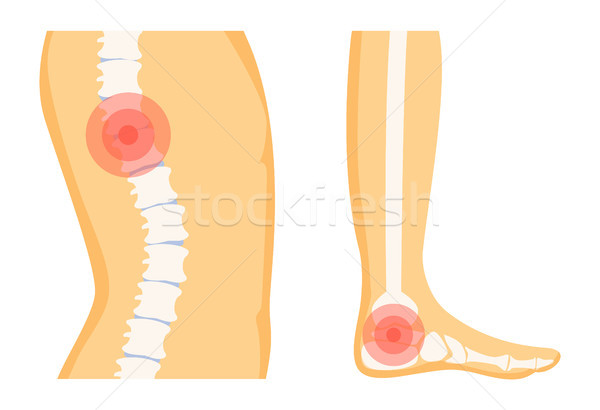 Sira spinarii picior trauma set parti ale corpului roşu Imagine de stoc © robuart