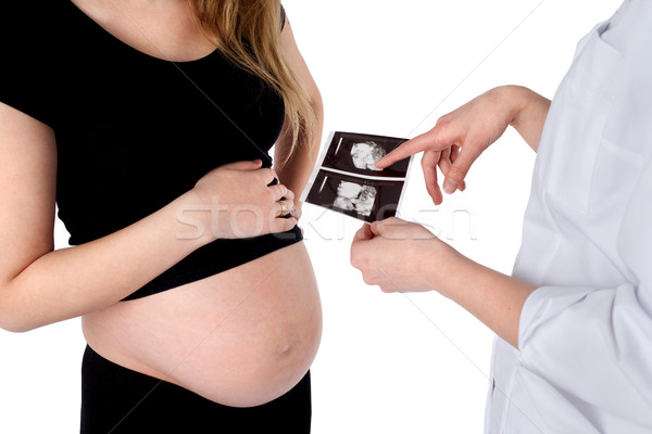 Mujer embarazada médico ultrasonido escanear aislado Foto stock © rognar