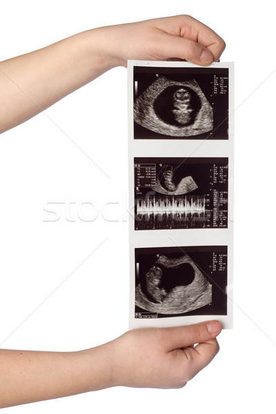 Ultrahang képek kezek tart baba izolált Stock fotó © rognar