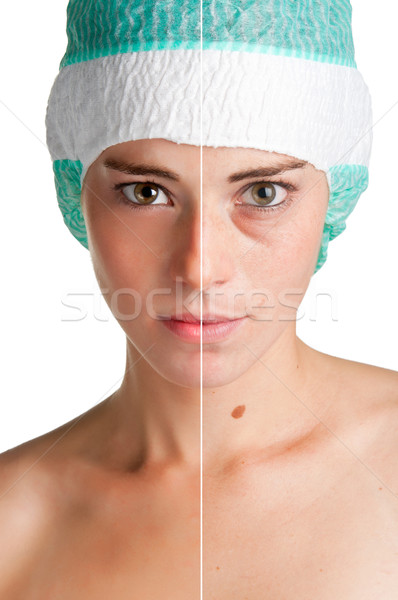 Bőrápolás portré fiatal nő bőrkezelés arc orvos Stock fotó © ruigsantos