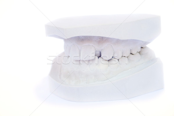 Zęby gips model ludzi uśmiech usta Zdjęcia stock © ruzanna