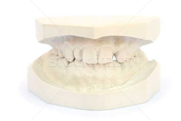 Zęby gips model odizolowany biały uśmiech Zdjęcia stock © ruzanna