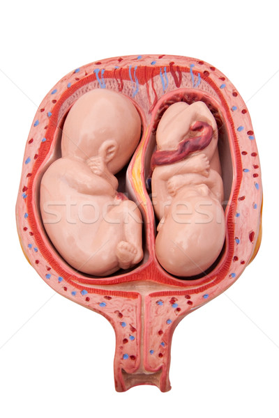 Zwillinge medizinischen Modell twin Gebärmutter Baby Stock foto © Saphira