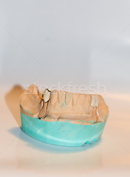 Dentaires implant [[stock_photo]] © Sarkao