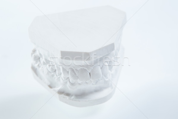Stock photo: Gypsum model of human jaw on a white background.