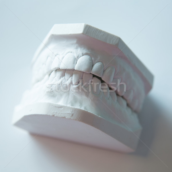 гипс модель человека челюсть белый стоматологических Сток-фото © sarymsakov