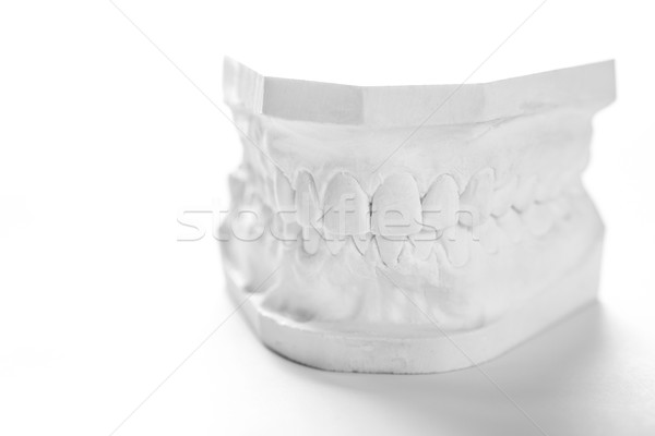 Stock photo: Gypsum model of human jaw on a white background.