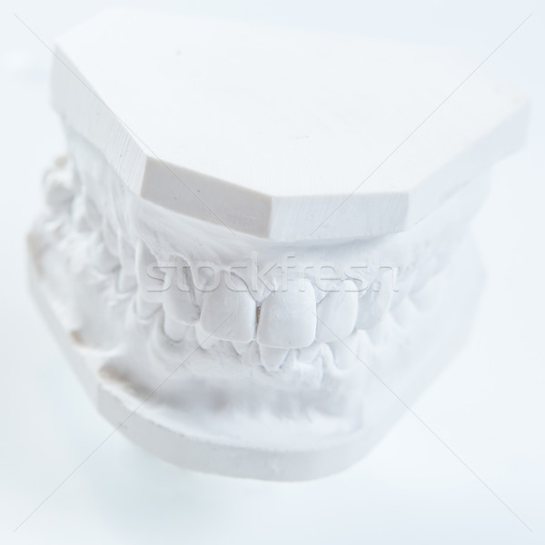 石膏 模型 人的 顎 白 選擇性的重點 商業照片 © sarymsakov