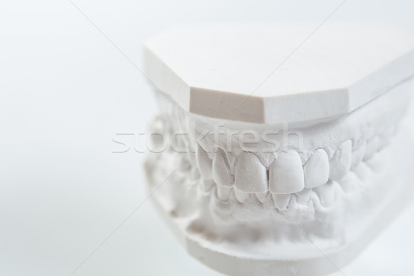 Gypsum model of human jaw on a white background. Stock photo © sarymsakov