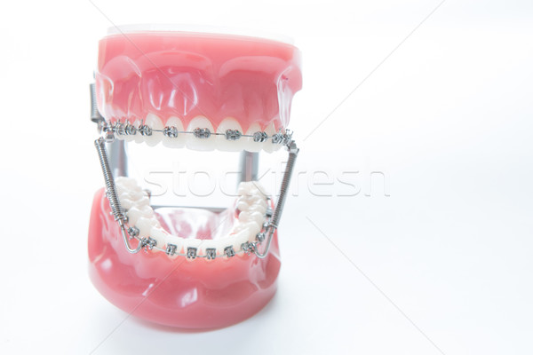 Dentales bajar mandíbula tirantes modelo blanco Foto stock © sarymsakov