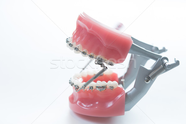 Stock photo: Dental lower jaw bracket braces model on white