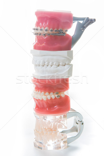 Dental model Stock photo © sarymsakov