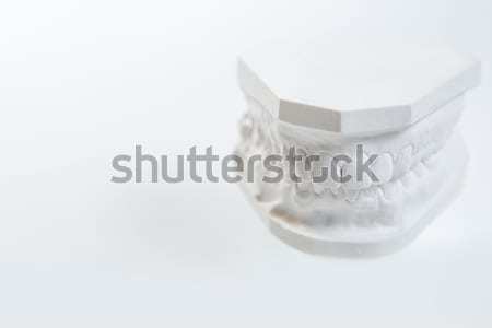 Gips model ludzi szczęka biały stomatologicznych Zdjęcia stock © sarymsakov
