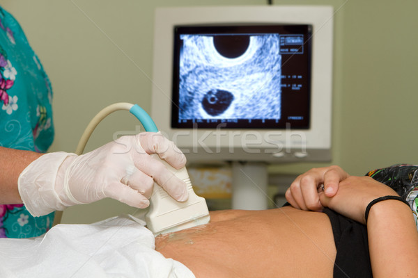 Ciąży ultradźwięk technik warunek kobieta w ciąży Zdjęcia stock © sframe