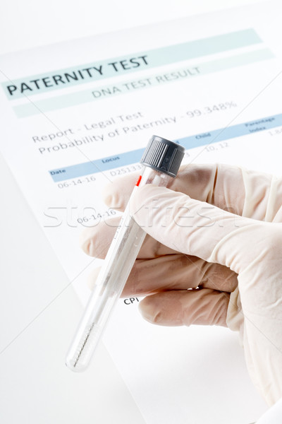 Paternity test result form with doctor holding buccal swab in te Stock photo © ShawnHempel