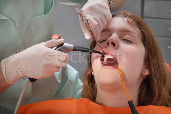 Dental procedure, splashing tooth Stock photo © simazoran