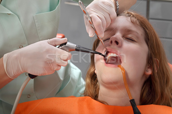 Dental procedure, splashing tooth Stock photo © simazoran