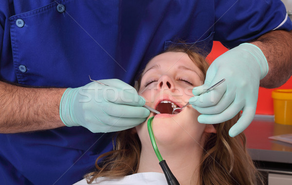 Dentar dinte umplere dentist pacient Imagine de stoc © simazoran