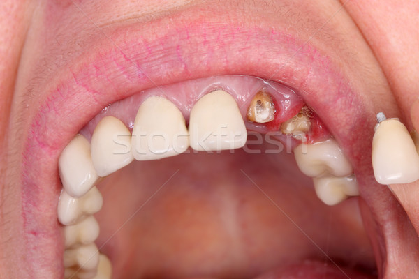 Dental Stock photo © simazoran