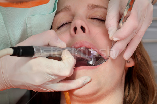 Dental procedure, drilling tooth Stock photo © simazoran