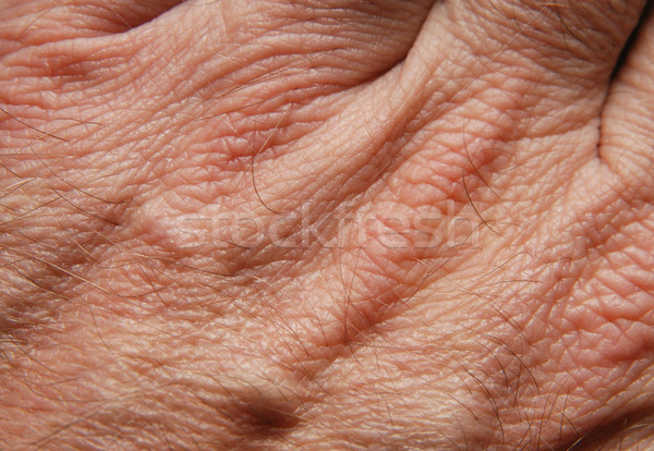 Human skin Stock photo © simazoran