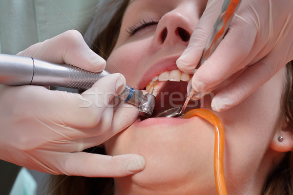 Foto stock: Dental · perfuração · dente · dentista · jovem