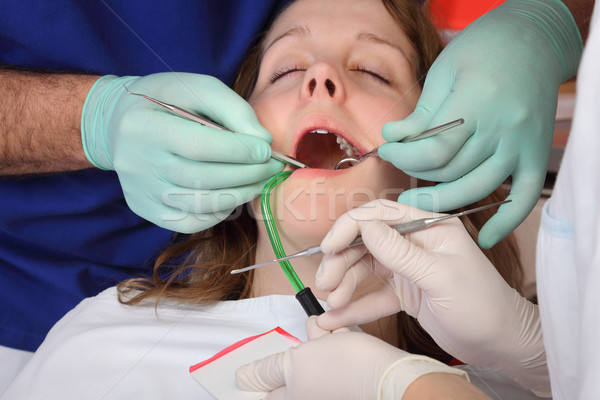 Zahnärztliche Verfahren Zahn Füllung Zahnarzt Krankenschwester Stock foto © simazoran