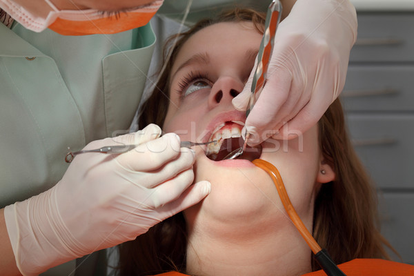 Dental procedure, drilling and filling tooth Stock photo © simazoran