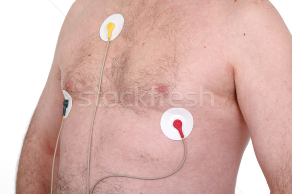 Electrocardiograma caucazian om monitoriza inimă Imagine de stoc © simazoran