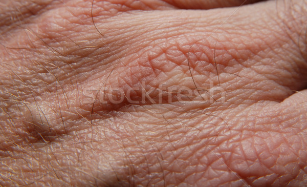 Humaine peau main homme résumé [[stock_photo]] © simazoran