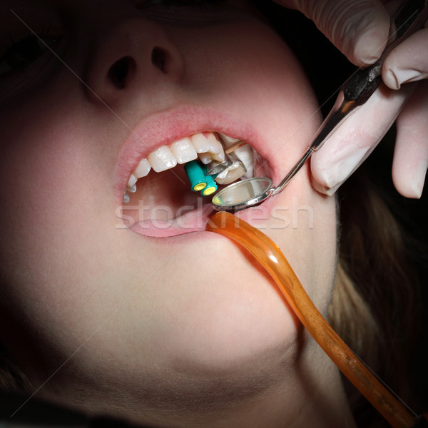 Dental procedure, drilling and filling tooth Stock photo © simazoran