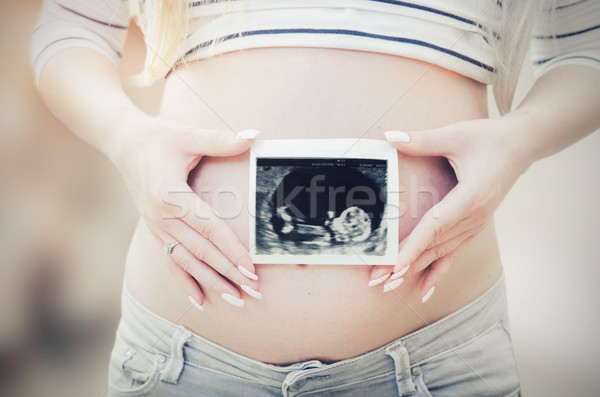 Pregnant woman holding ultrasound scan on her belly Stock photo © simpson33